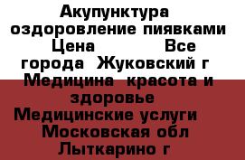 Акупунктура, оздоровление пиявками › Цена ­ 3 000 - Все города, Жуковский г. Медицина, красота и здоровье » Медицинские услуги   . Московская обл.,Лыткарино г.
